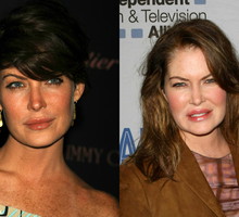 Lara Flynn Boyle, ofiary botoksu
