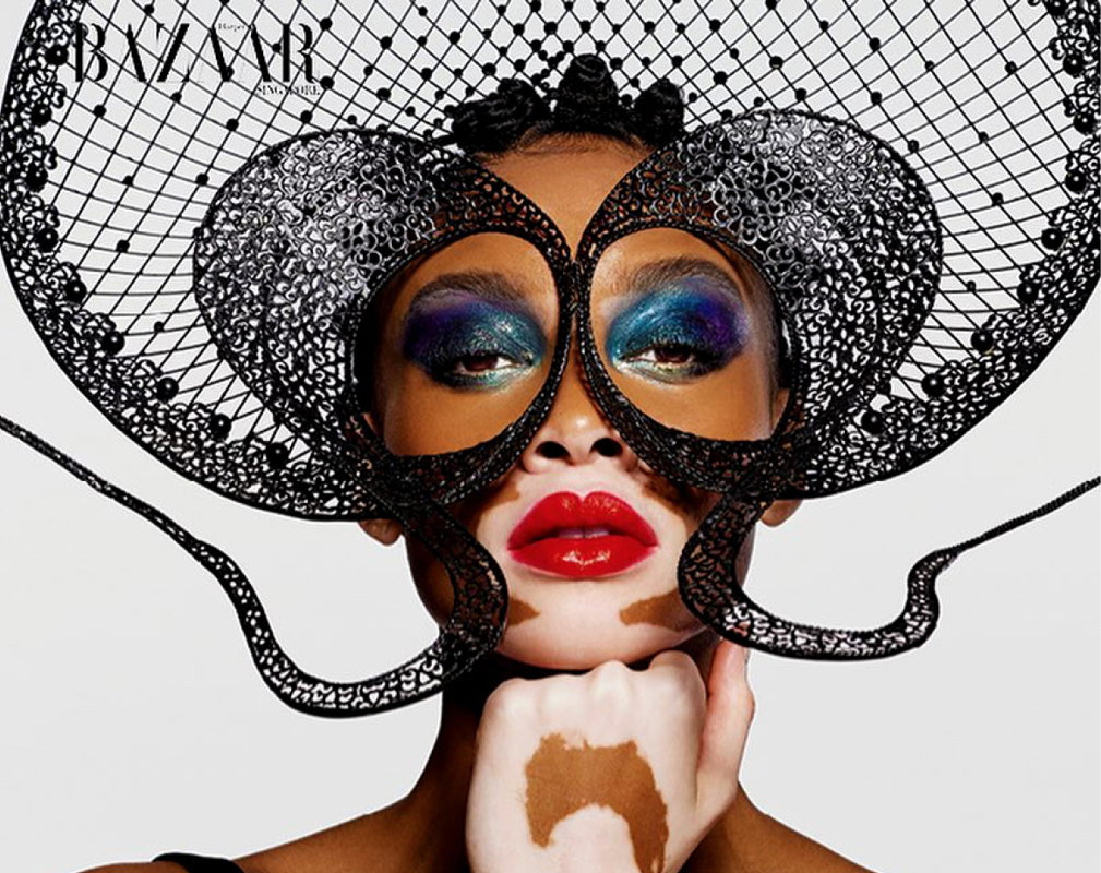 Modelka z bielactwem, Winnie Harlow dla Harper's Bazaar