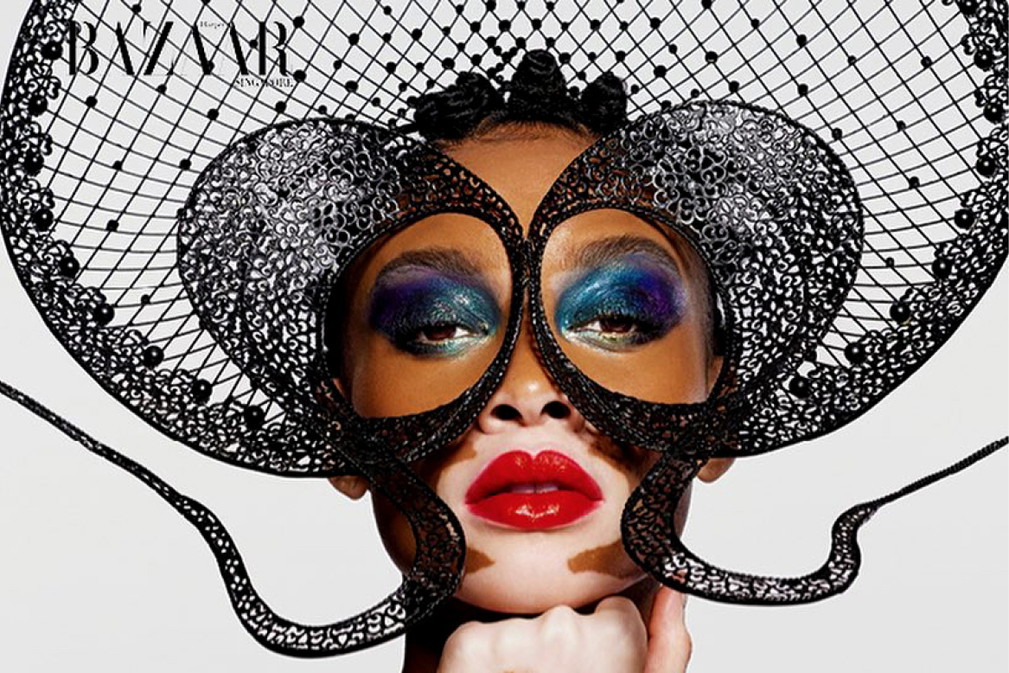 Modelka z bielactwem, Winnie Harlow dla Harper's Bazaar
