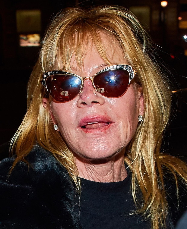 Melanie Griffith z ranami na nosie i ustach