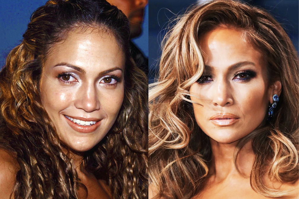 jlo2