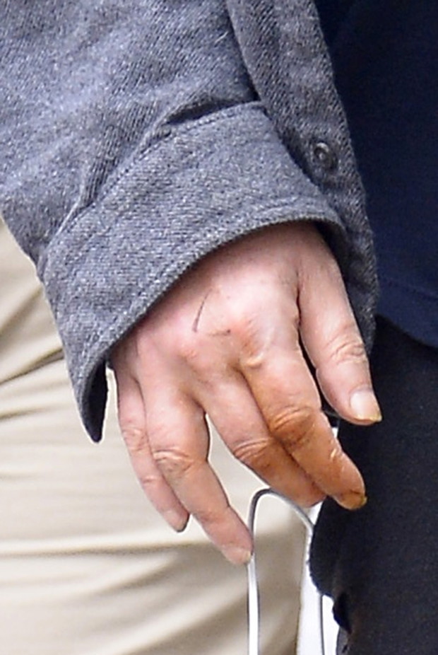 Matthew Perry ma spuchni?te d?onie