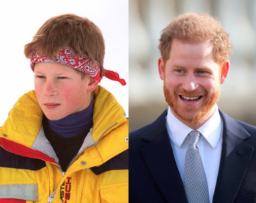 książę Harry, metamorfoza