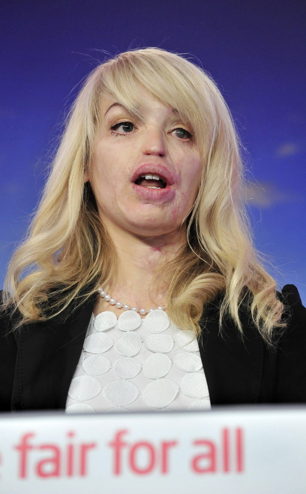 Katie Piper, 2010 rok