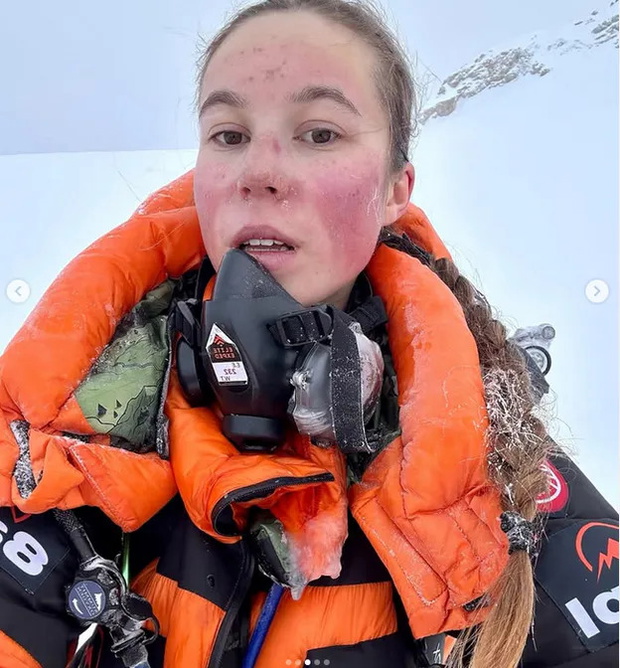 Zoja Skubis Instagram