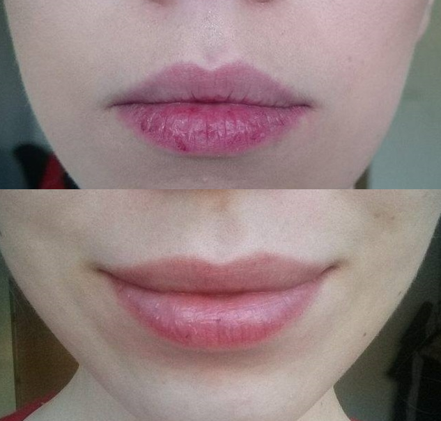 Usta przed i po stosowaniu olejków do ust AA, Caring Lip Oil