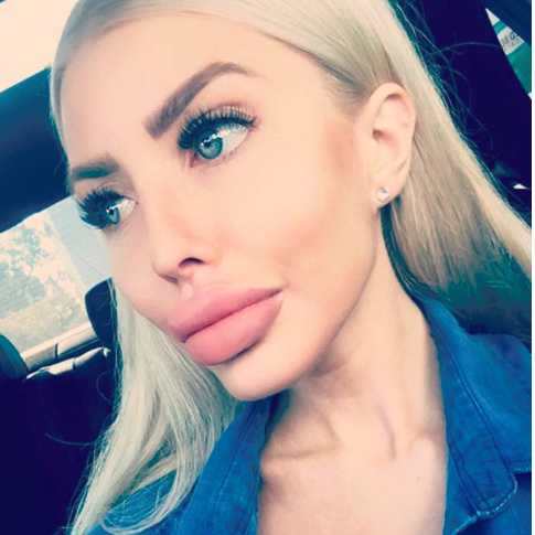 Anella