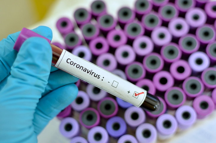 Jak krzepliwość krwi wpływa na COVID-19