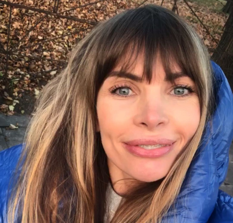 Agnieszka Dygant powiększyła usta?