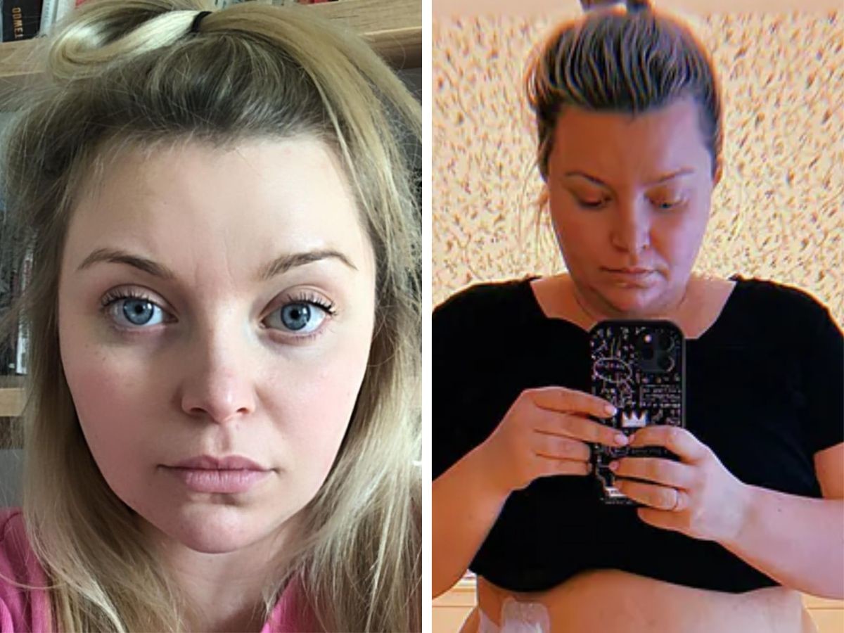 Justyna Mazur po operacji zmniejszenia żołądka