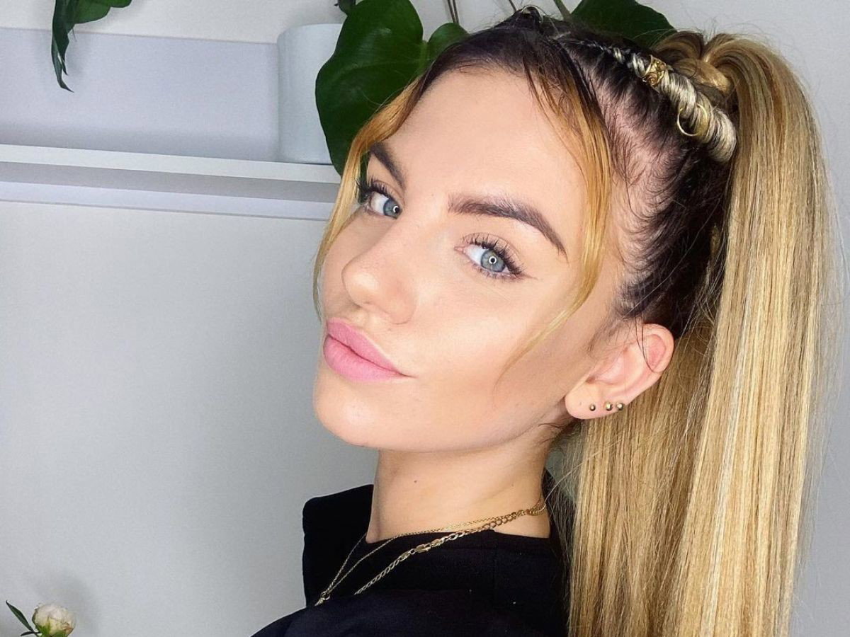 Sonia Szklanowska z Hotel Paradise o nieudanych zabiegach medycyny estetycznej