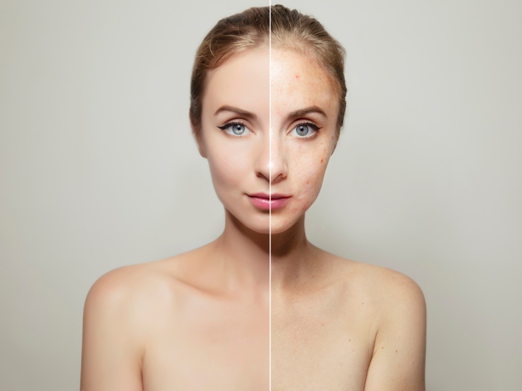 woman-face-portrait-with-clear-and-pimpled-skin-picture-id1143099925