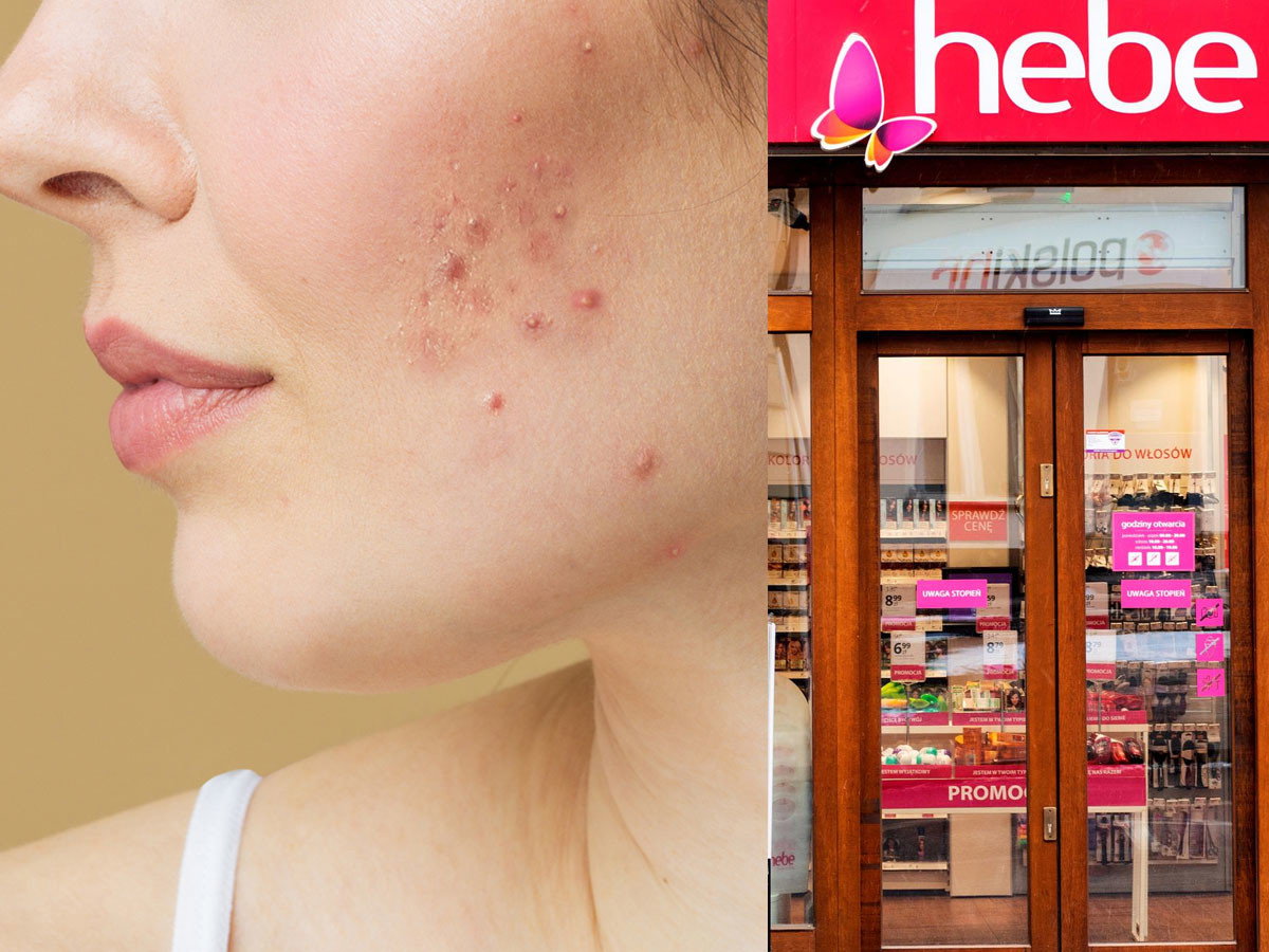 Black Friday w Hebe! Ten dermokosmetyk do twarzy na promocji -40%, likwiduje