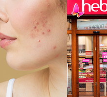 Black Friday w Hebe! Ten dermokosmetyk do twarzy na promocji -40%, likwiduje