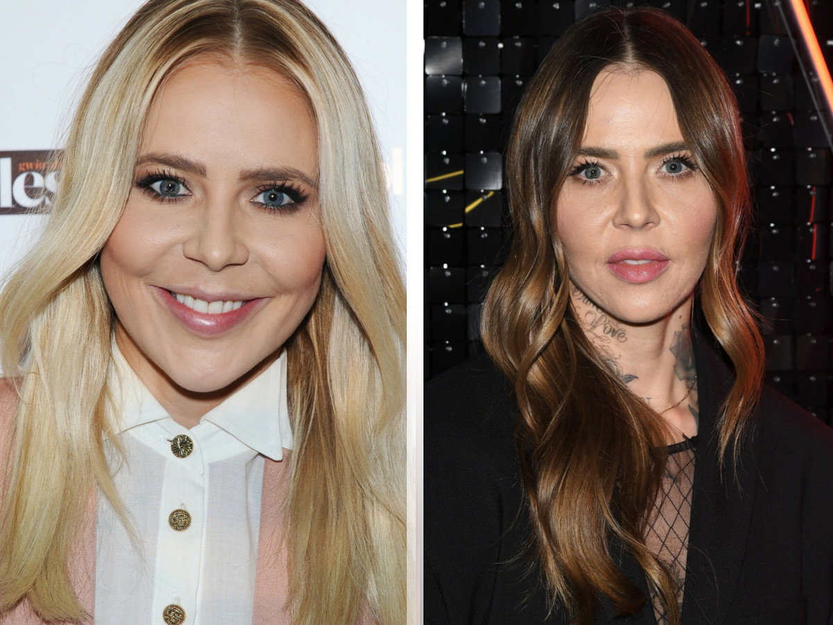 Maja Sablewska wyznaje: popełniłam bardzo wiele błędów z medycyną estetyczną