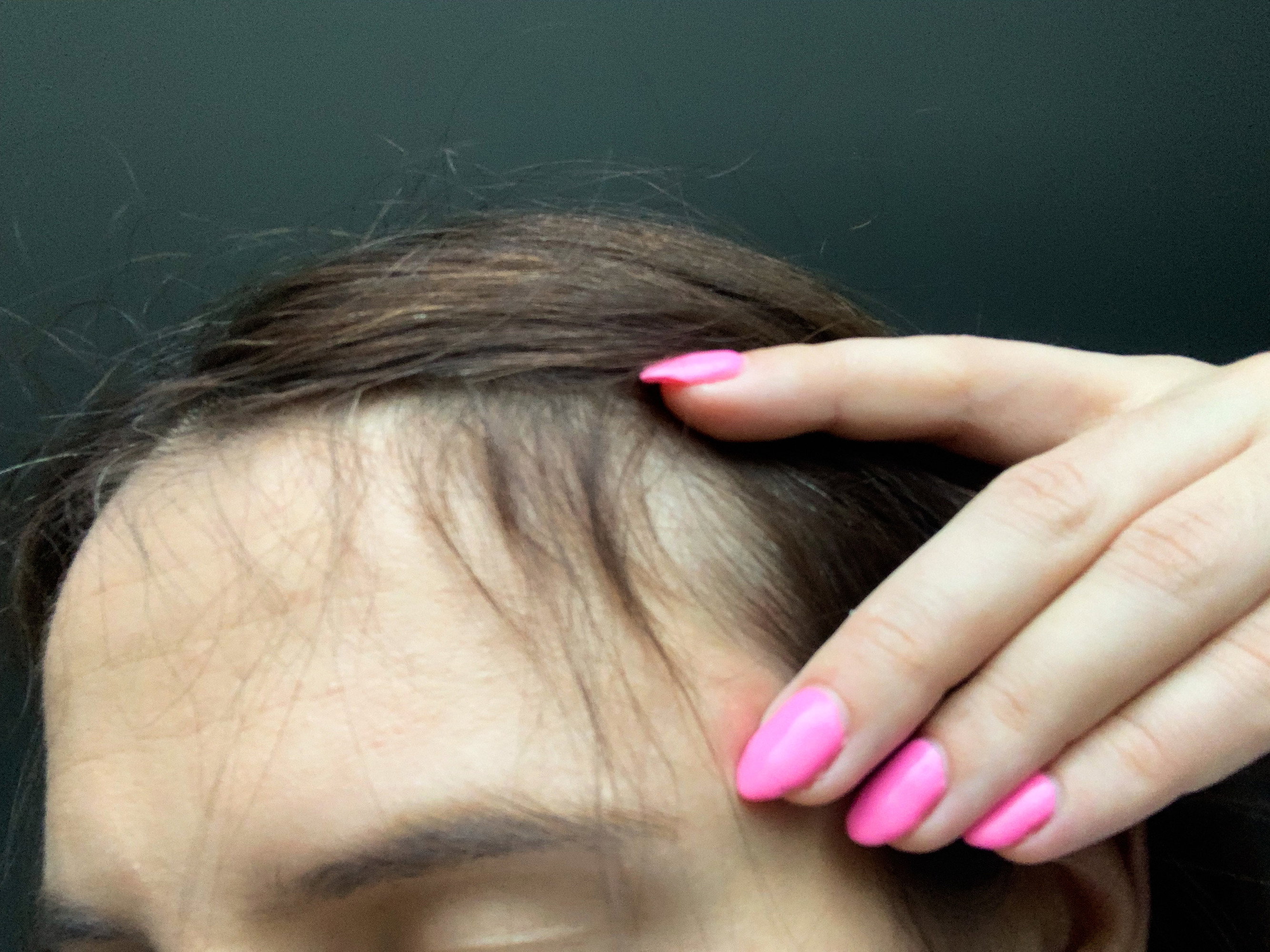 baby hair - efekty po stosowaniu wcierki do włosów