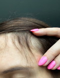 baby hair - efekty po stosowaniu wcierki do włosów