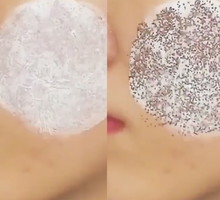 Wągry wyciągnięte maską Green Mask Mealo