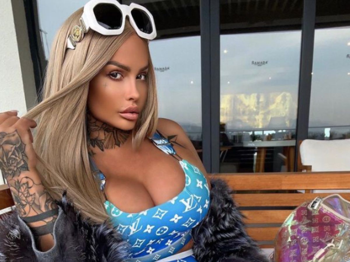 Królowe życia: Laluna pokazała tragiczne zdjęcia po operacji [ZDJĘCIA 18+]2