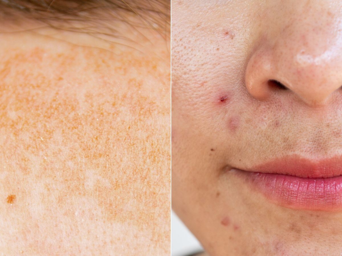 Skoncentrowane serum wygładzające Eveline