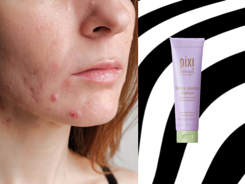 cera przed kuracją retinolem - Pixi Retinol Jasmine Cleanser