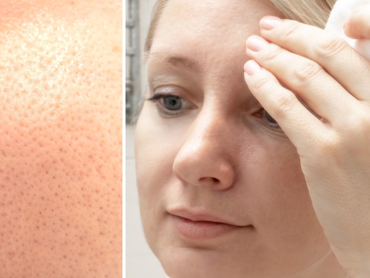 Eveline PERFECT SKIN ACNE Seboregulujący tonik zwężający pory