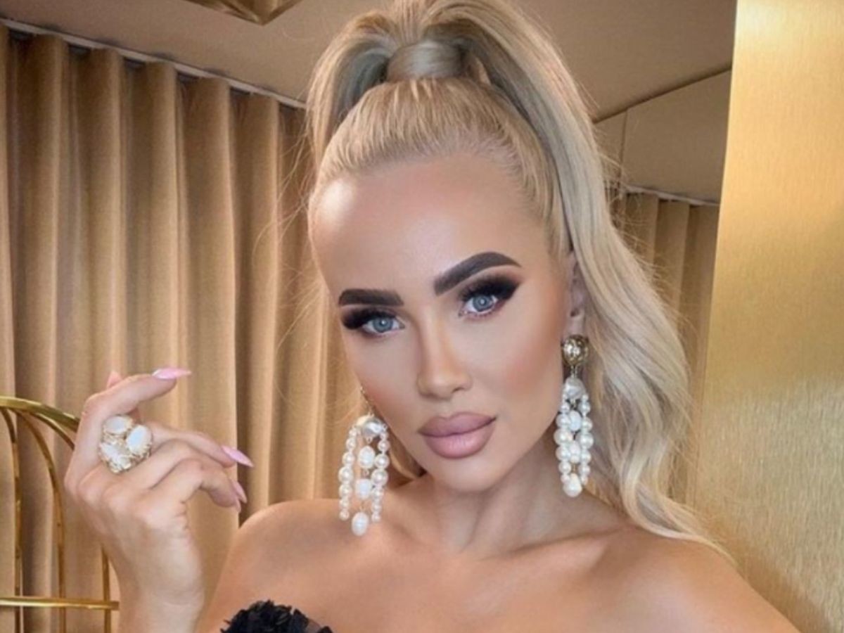 Królowe życia: Izabela Macudzińska powiększyła usta8