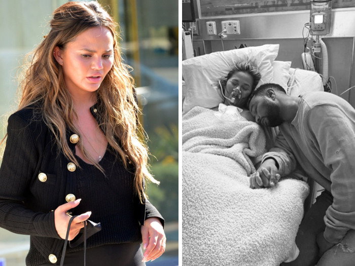 Dlaczego Chrissy Teigen poroniła w zaawansowanej ciąży?