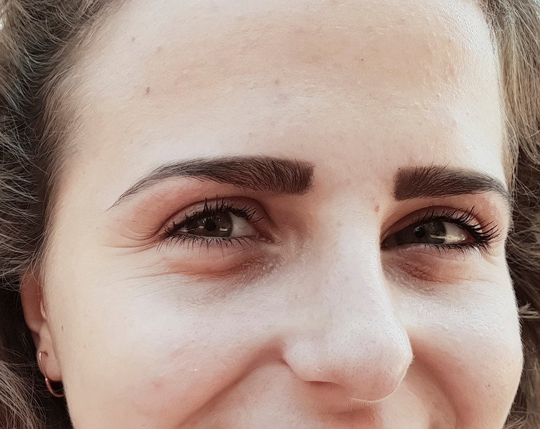 worki i cienie pod oczami