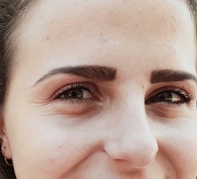 worki i cienie pod oczami