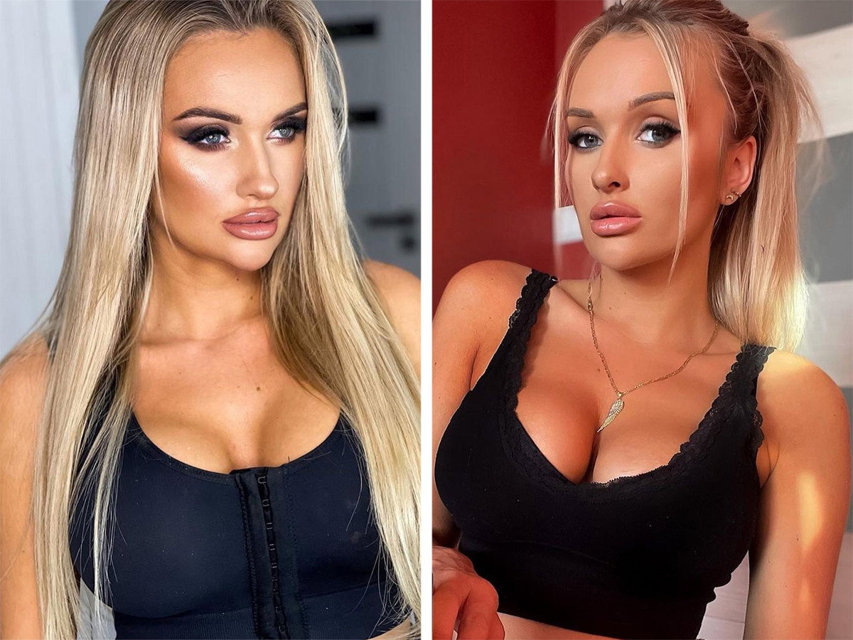 Aleksandra z Love Island kolejny raz zoperowała biust