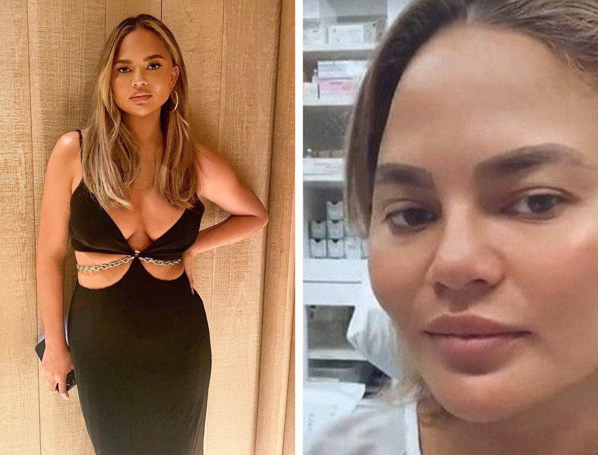 Chrissy Teigen poprawione brwi