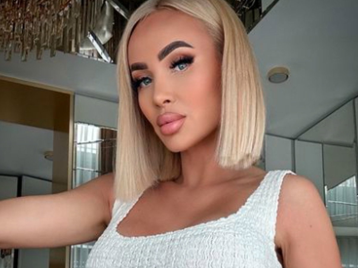 Izabela Macudzińska po operacji plastycznej w tureckiej klinice. Co sobie poprawiła? Pokazała efekty! Ale zmiana