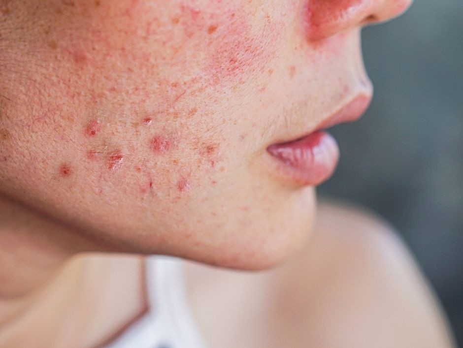 Maseczka Purederm