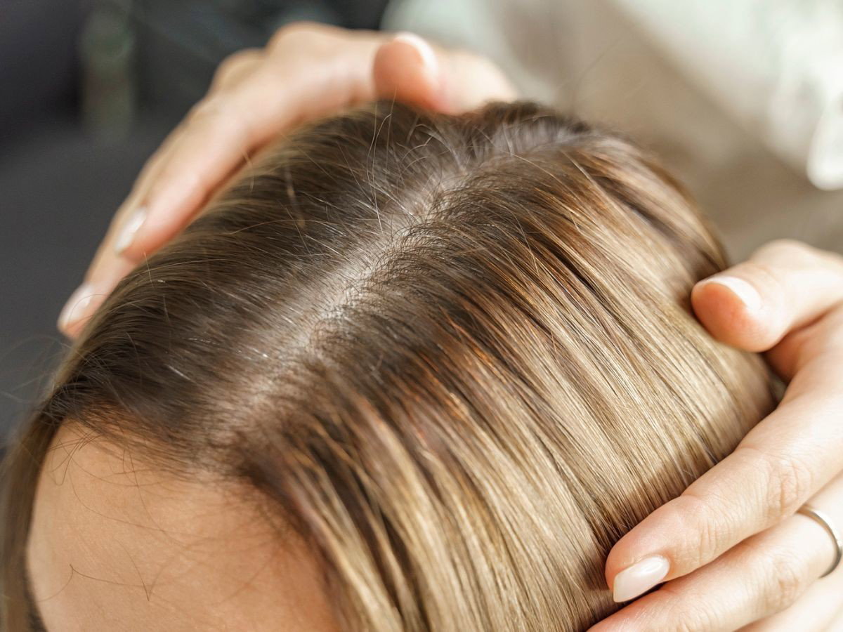 dermo hair. podrażnienie. serum wspierające mikrobiom skóry głowy