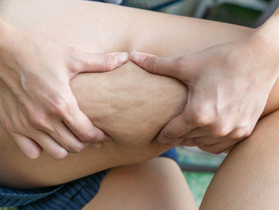 Domowa kuracja antycellulitowa z imbirem