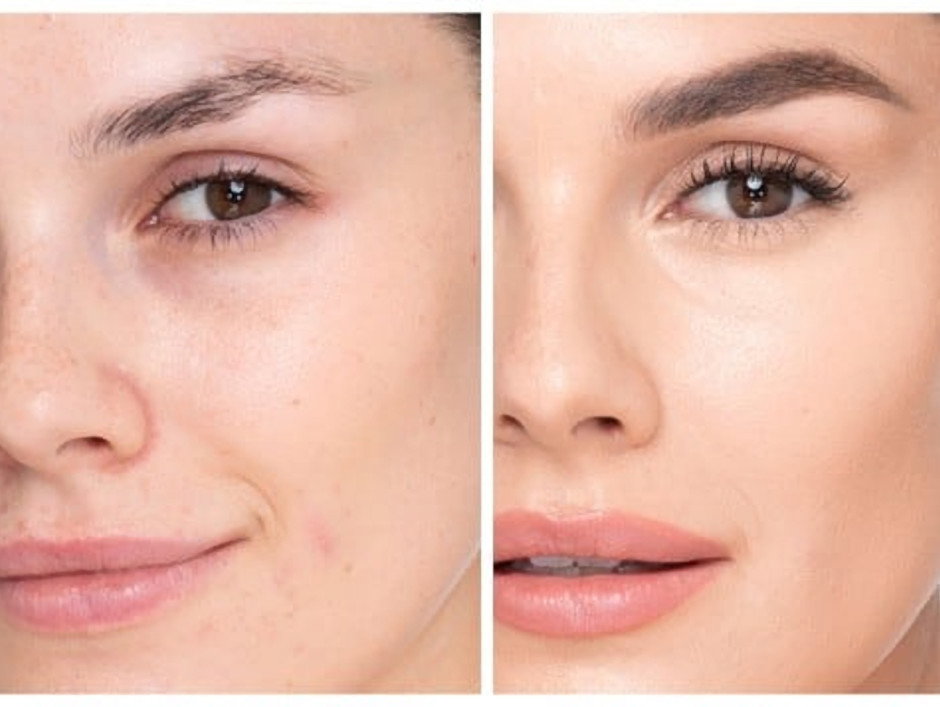 podkład do twarzy Charlotte's Beautiful Skin Foundation - Charlotte Tilbury