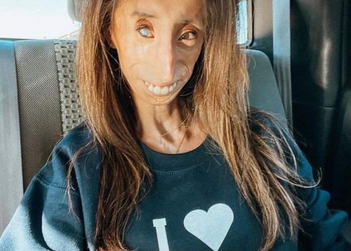 Lizzie Velasquez