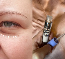 serum pod oczy Bell z Biedronki - cienie i worki pod oczami