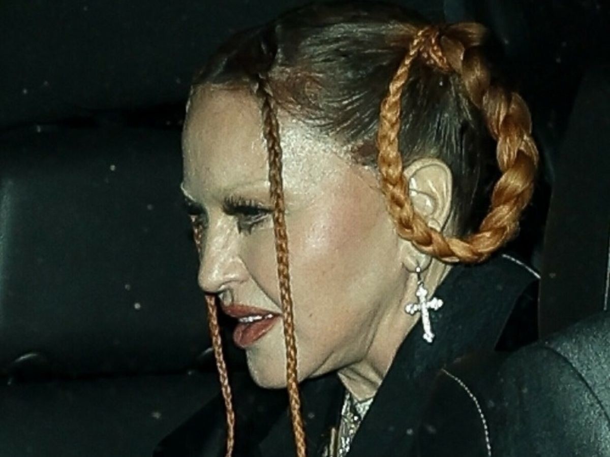 Madonna w coraz gorszym stanie