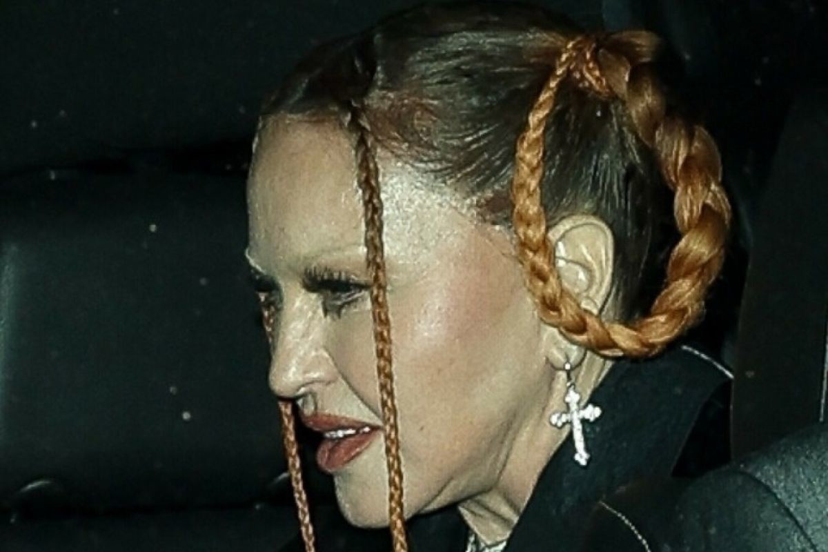 Madonna w coraz gorszym stanie