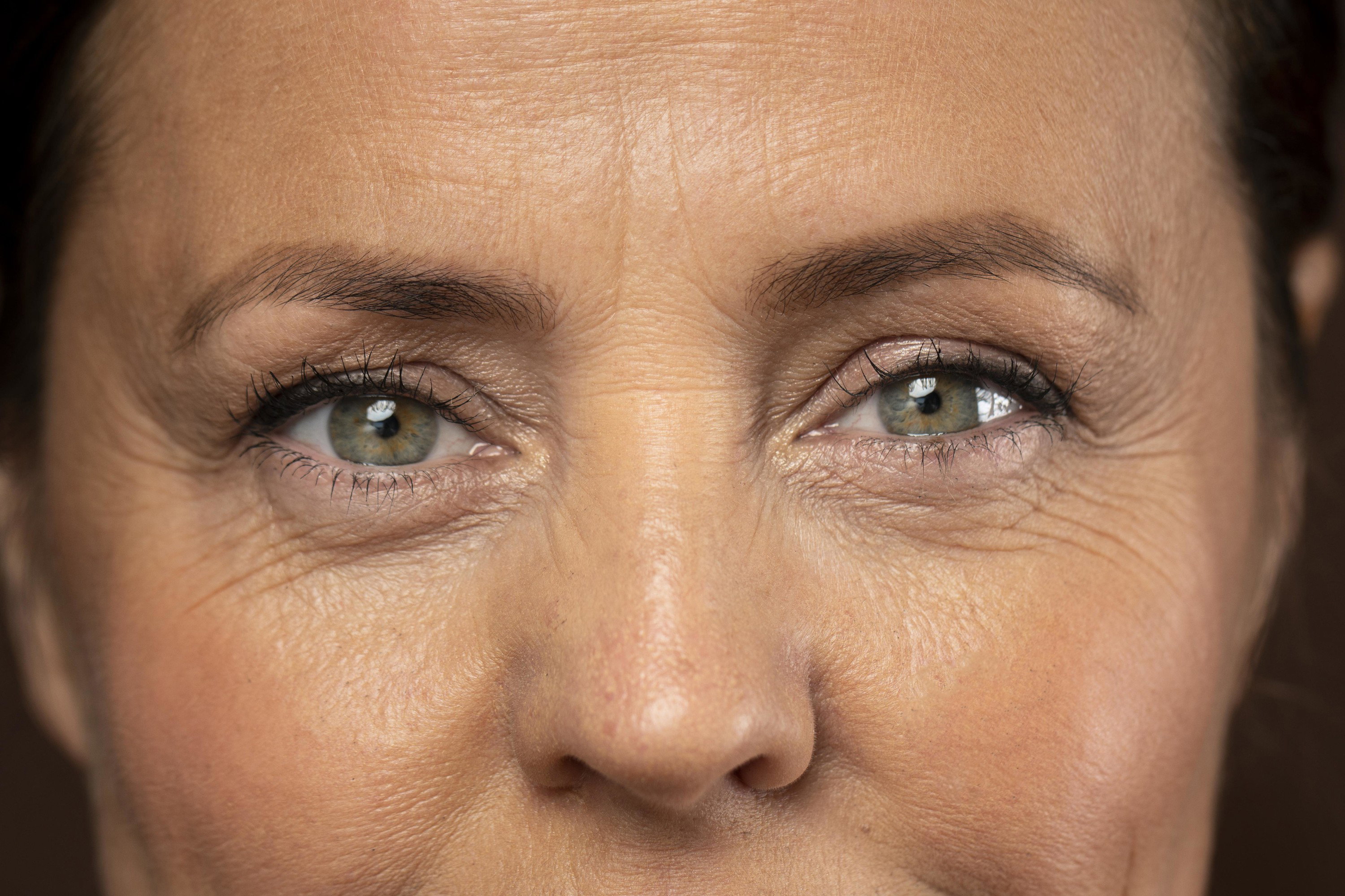bioderma