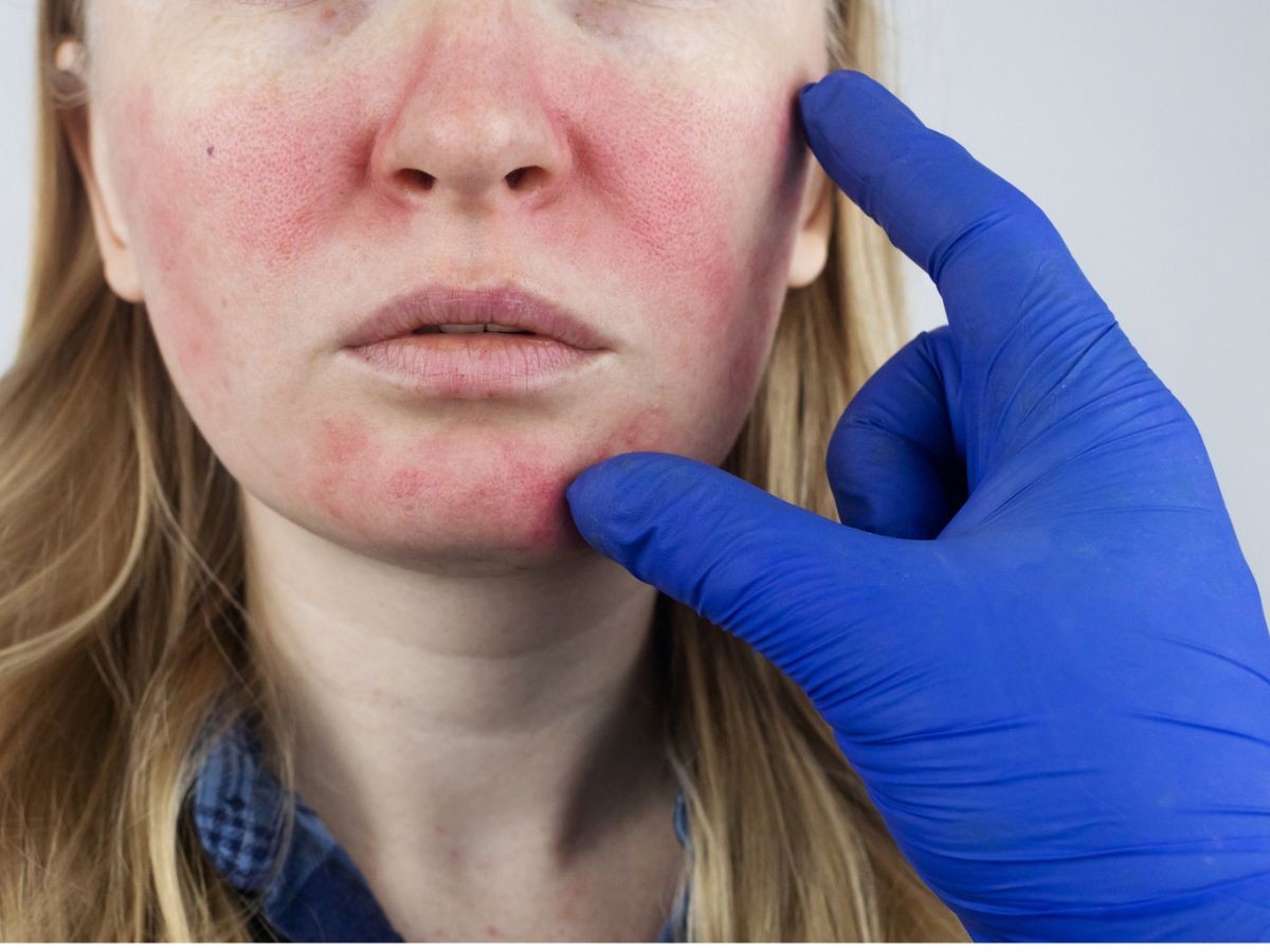 dermatolog