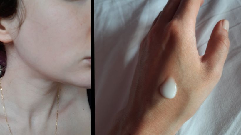 Serum z 4x kwasem hialuronowym w 28 dni działa na moją skórę jak kilka sesji masażu kobido. Zmarszczki znikają jakby je ktoś wypełnił