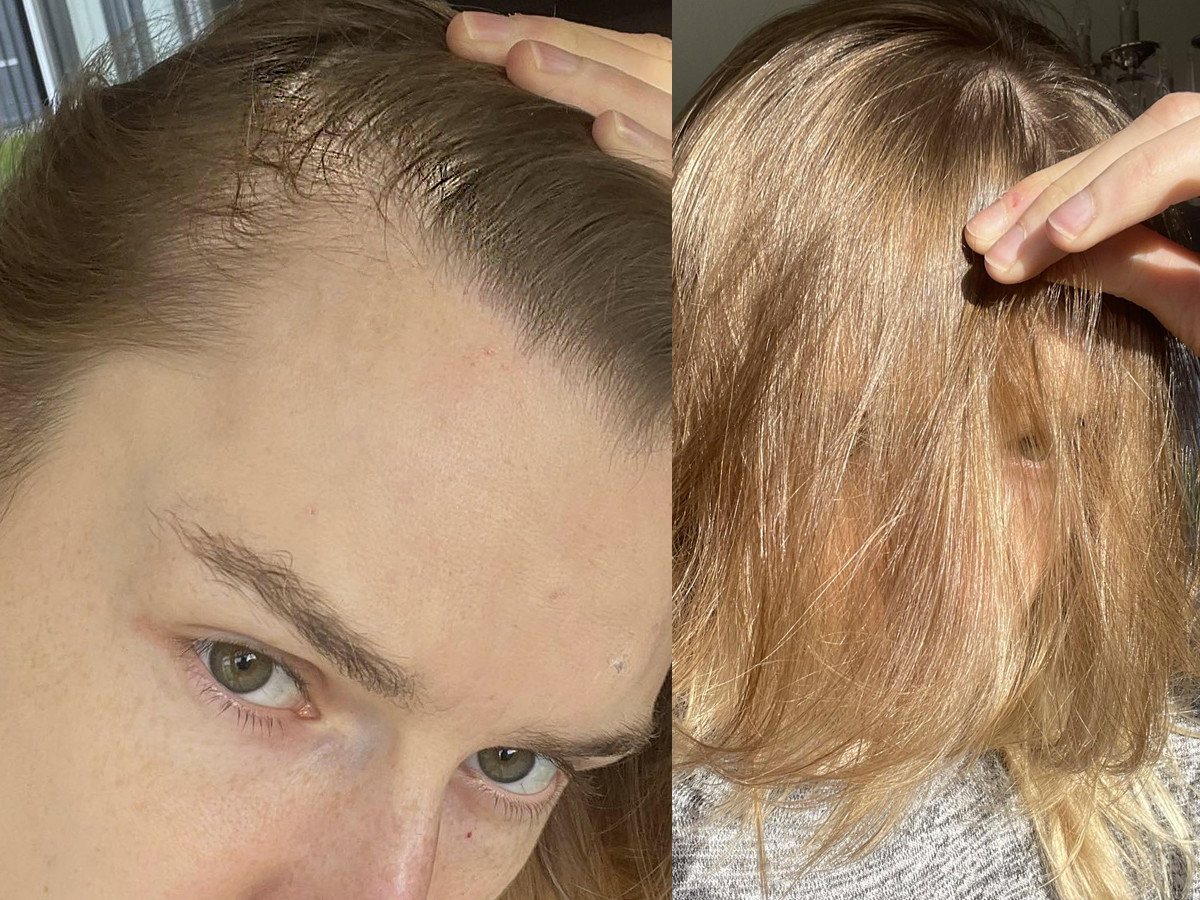 Zakola, baby hair