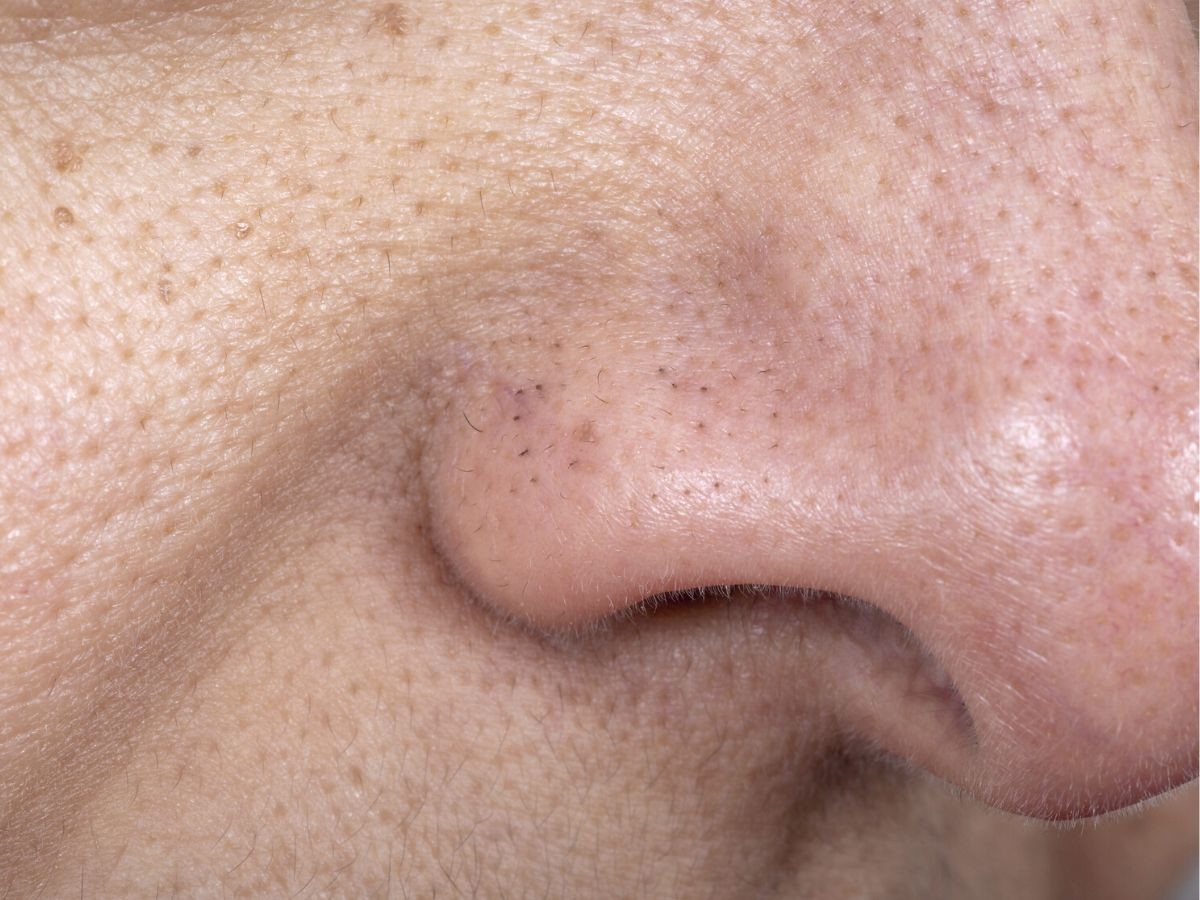 Intensywna 7-dniowa kuracja nawadniająca [PGA + ekstrakt z jabłka] Miya cosmetics nowości