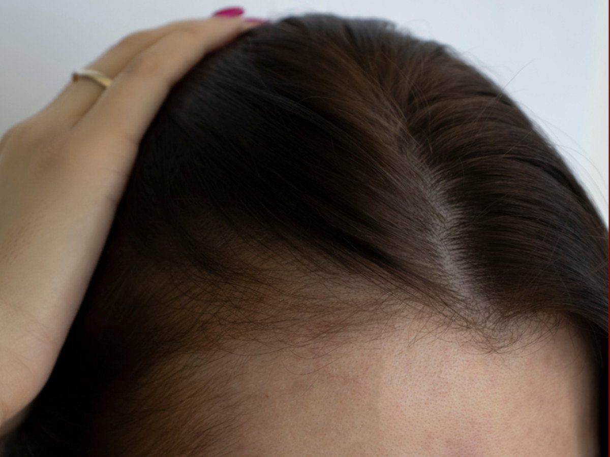 baby hair po zastosowaniu laserowego grzebienia