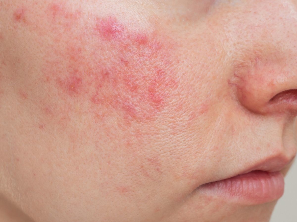 Nacomi Rose Face Mask Maska Różana Łagodząco-Uspokajająca