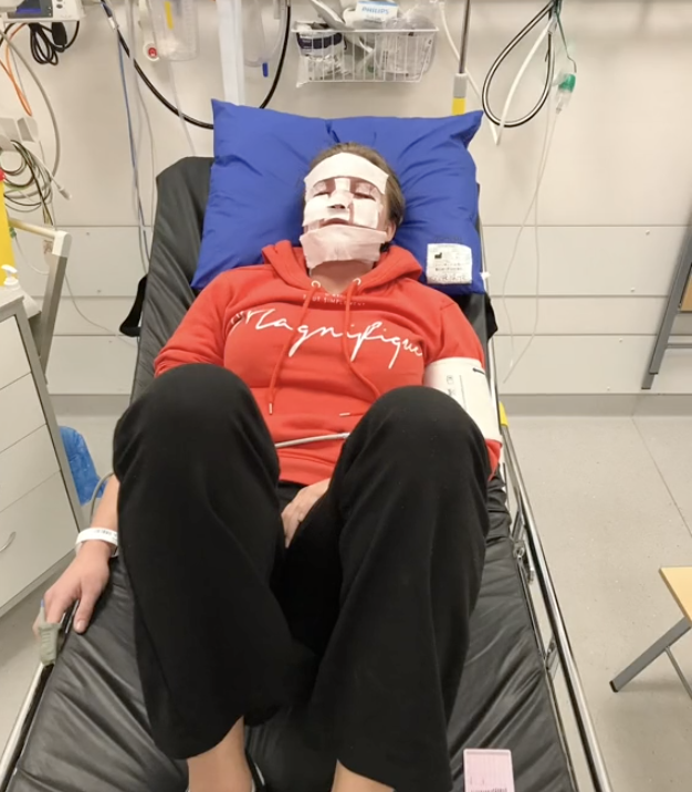 TikTokerka pokazała skutki opalania twarzy w solarium