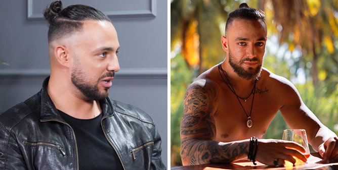 Krystian z "Hotelu Paradise" żałuje wolumetrii twarzy